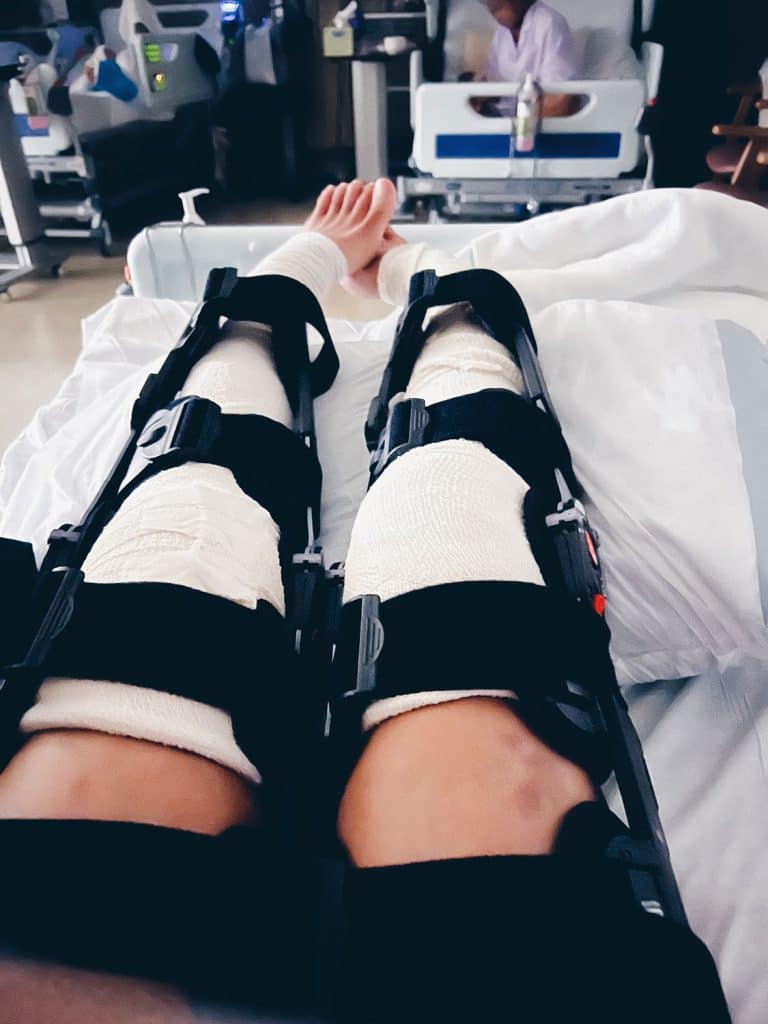 Leg braces and plaster cast post major knee surgery