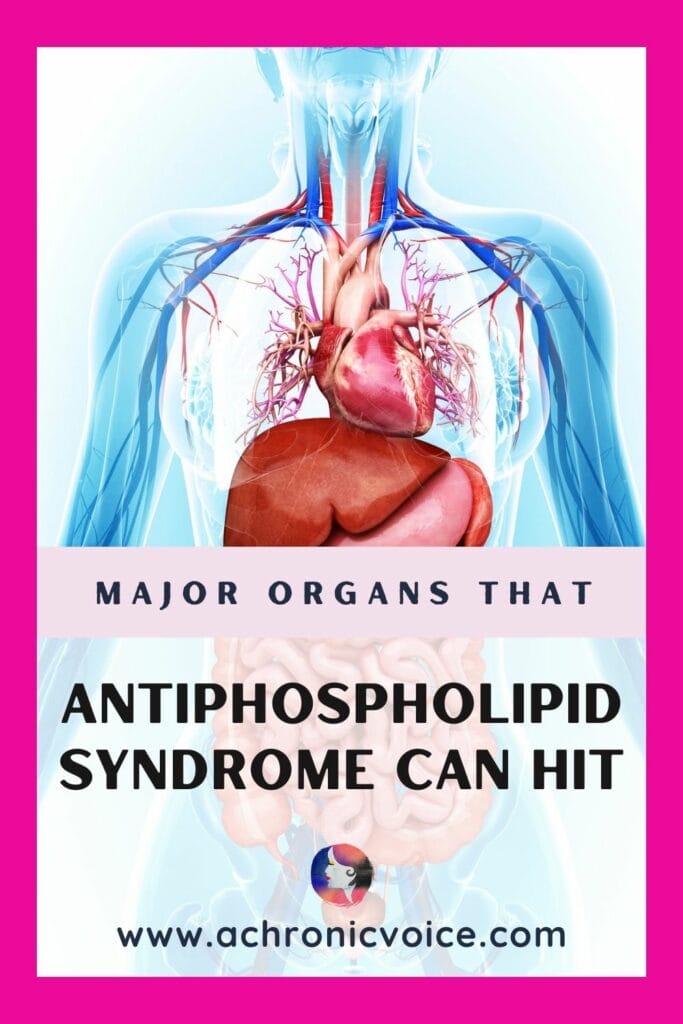 Major Organs that Antiphospholipid Syndrome Can Hit