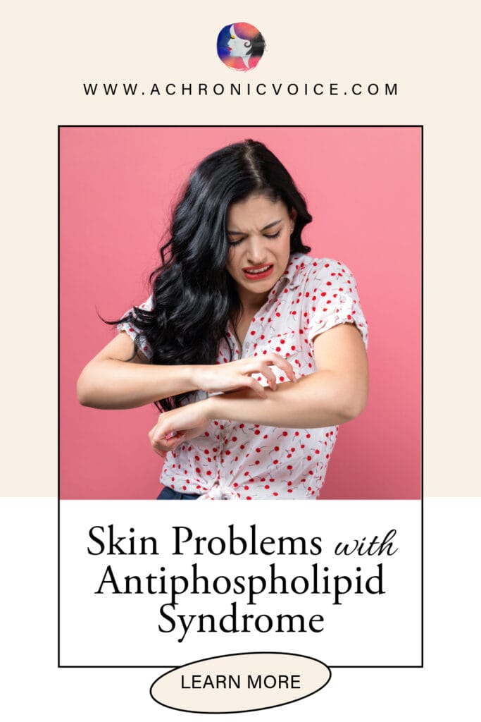 Skin Problems with Antiphospholipid Syndrome